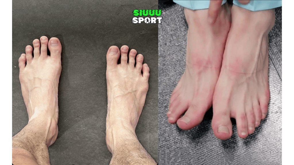 chan-be-ngang-nen-di-giay-da-bong-nao