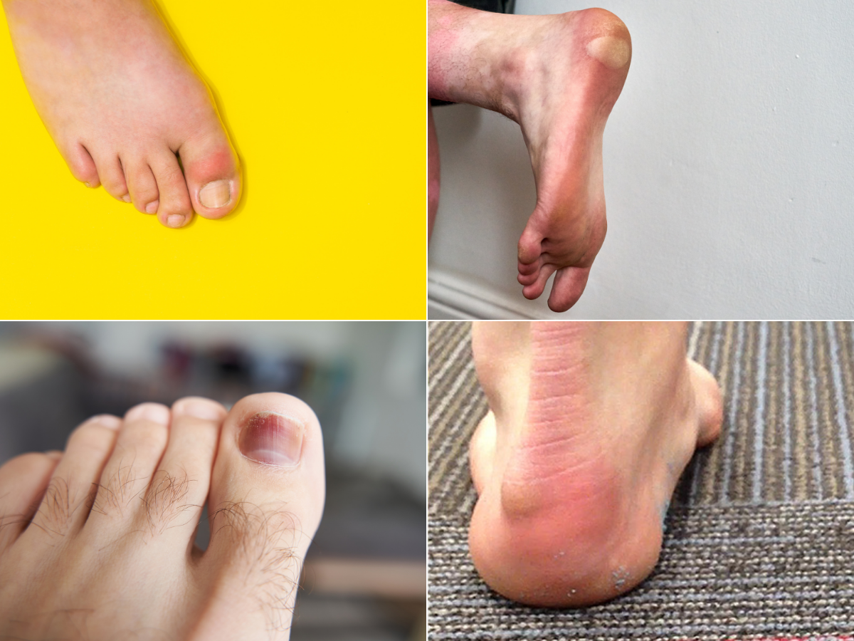 Vi sao can chon đung size giay đa banh